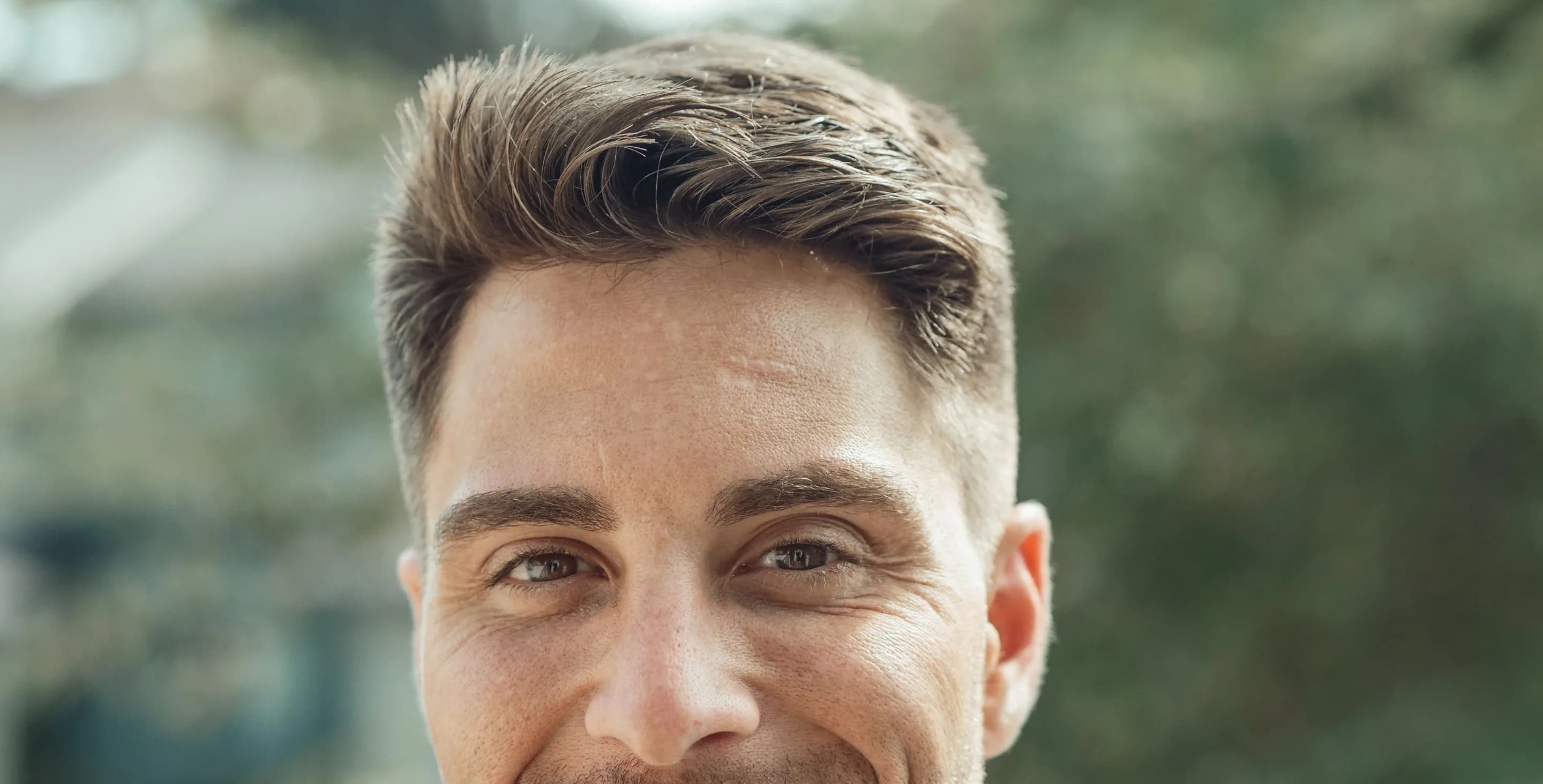 Smiling man outdoors, close-up of his hairline